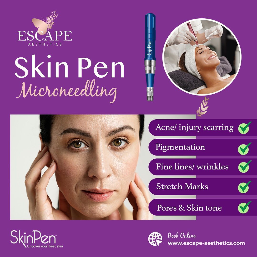 Laser Genesis Procedure, Cost, and What to Expect in Dunstable