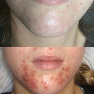 Dermalux Escape Aesthetics