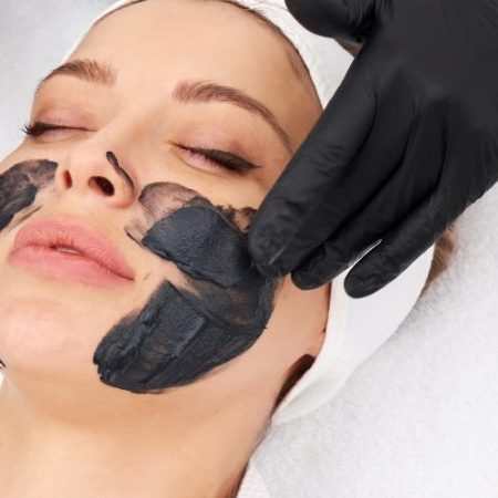 carbon-laser-facial